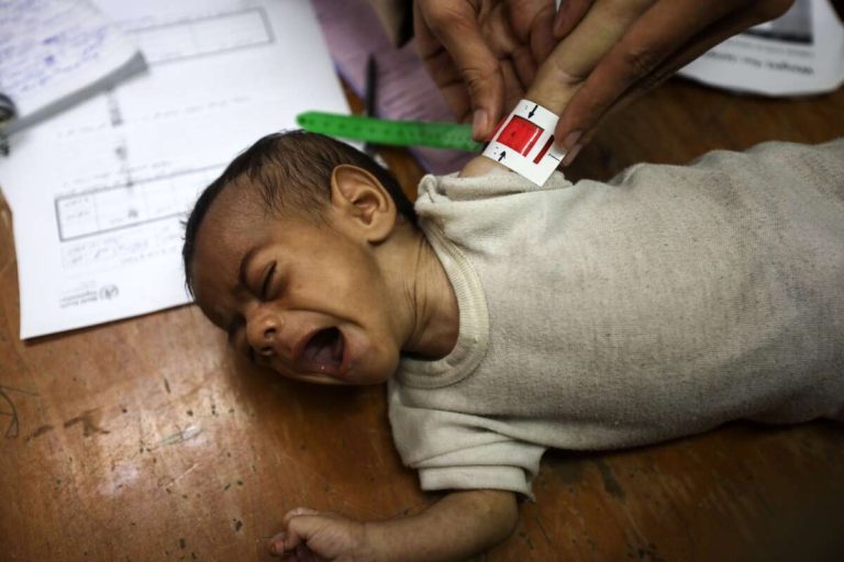 Israel Has Starved at Least 83 Children to Death in Gaza, Health Officials Say