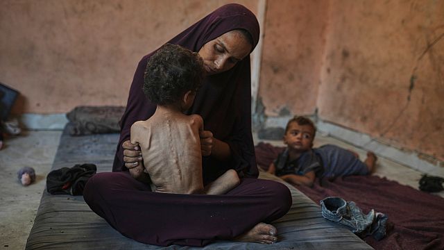 For the children of Gaza, hunger is a daily reality with a lasting impact