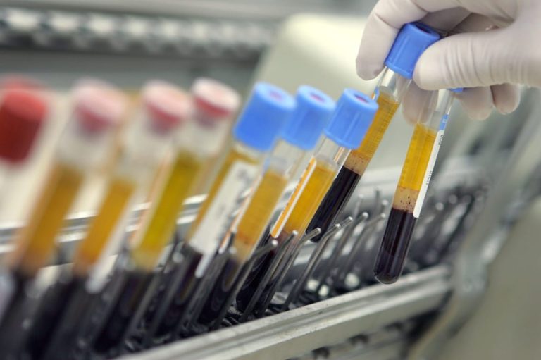 Every Dutch person has ‘forever chemicals’ in their blood