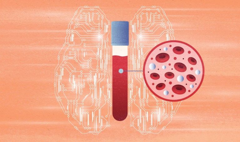 This New AI Method Can Speed Up  Cancer Detection