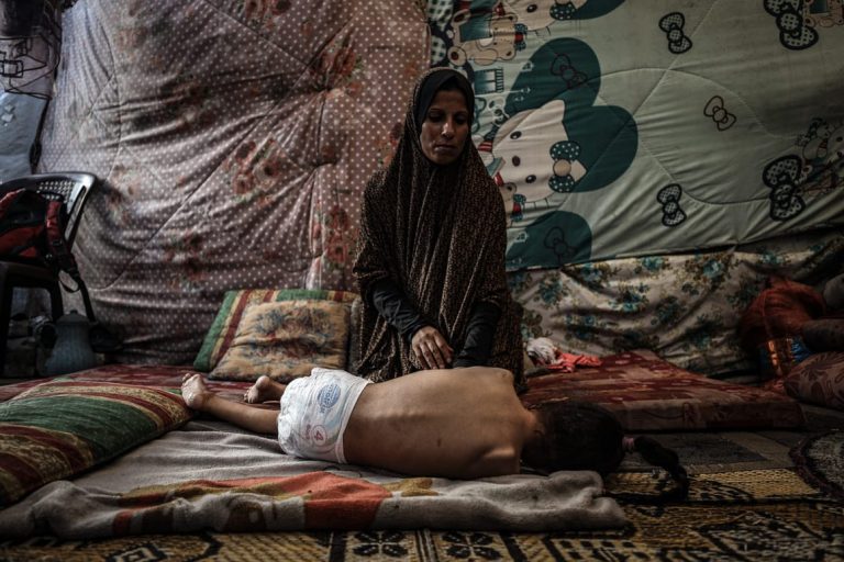 Doctors in Gaza struggle to fight rare paralytic illness under Israeli blockade