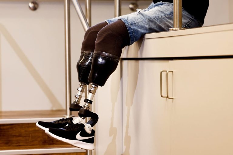 Kremlin official hails Ukraine war for helping ‘great leap’ in prosthetics