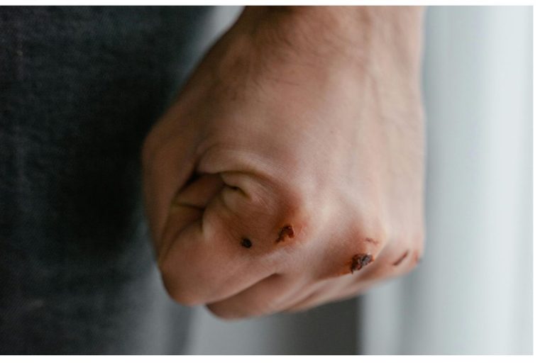 KZN man arrested over alleged assault after social media buzz