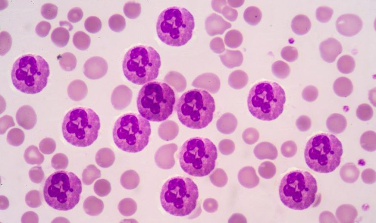 Scientists Redirect Body’s Cleanup Crew To Fight Disease