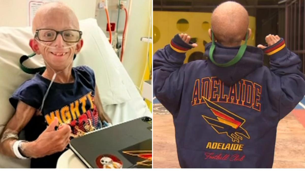 Vulnerable Adelaide teen urges sick Australians to stay home this winter