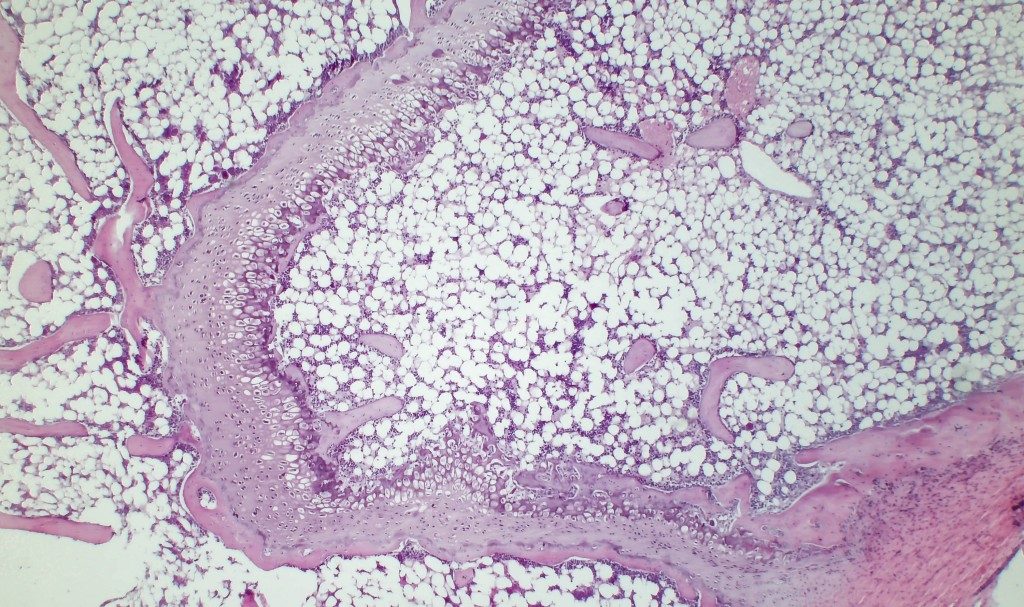 Researchers Identify The Cells That Make Space For Bone Marrow